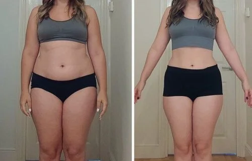 Antes e Depois 1