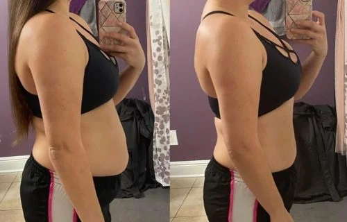 Antes e Depois 5