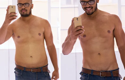 Antes e Depois 3