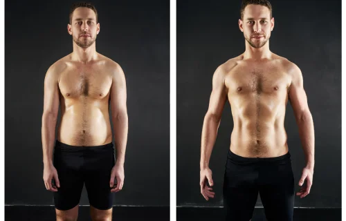 Antes e Depois 4